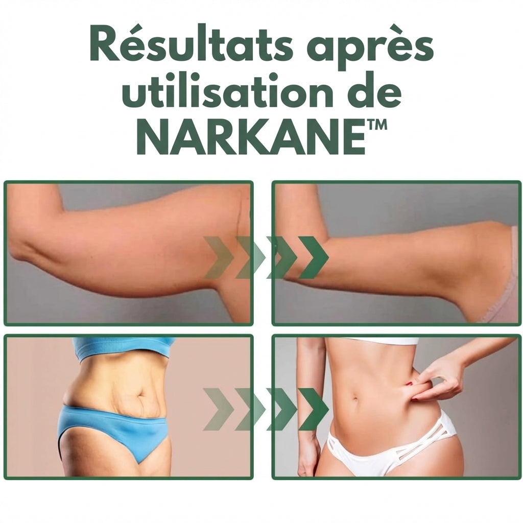 Narkane — Huile Collagène Raffermissante
